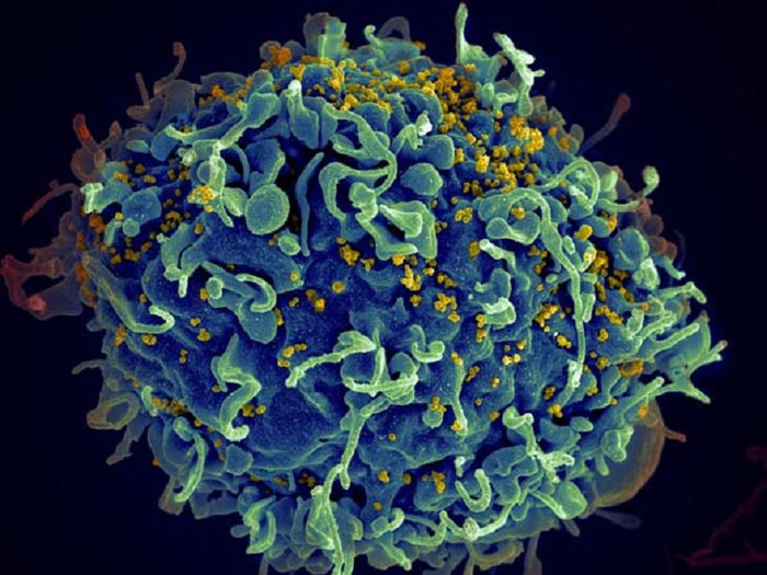 Covid, viste alterazioni del cervello a distanza di un anno - Biotech - ANSA.it
