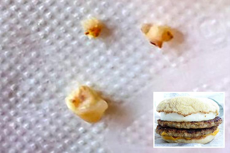 McDonald’s sorry after customer found ‘fragments of human teeth’ in his McMuffin | The Sun