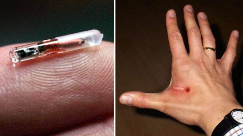 Italia in trattativa avanzata con azienda che produce microchip sottocutanei. I complottisti avevano ragione - Grandeinganno
