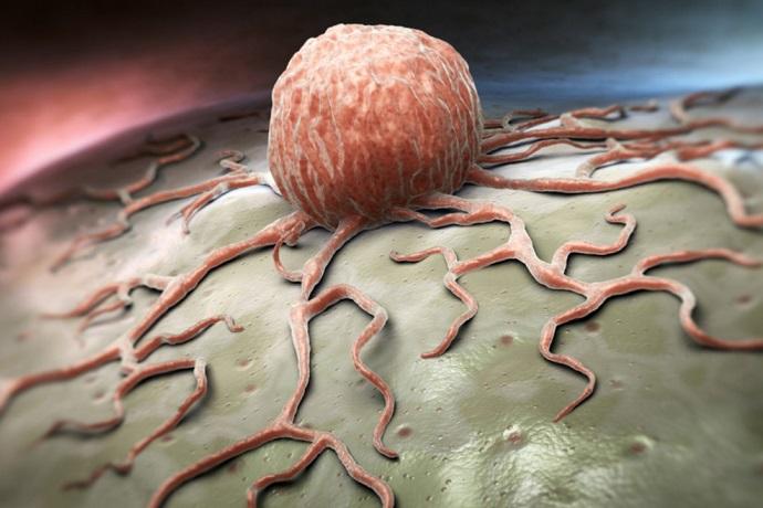 "SV40: un virus oncogenico emergente che causa tumori umani" - Grandeinganno