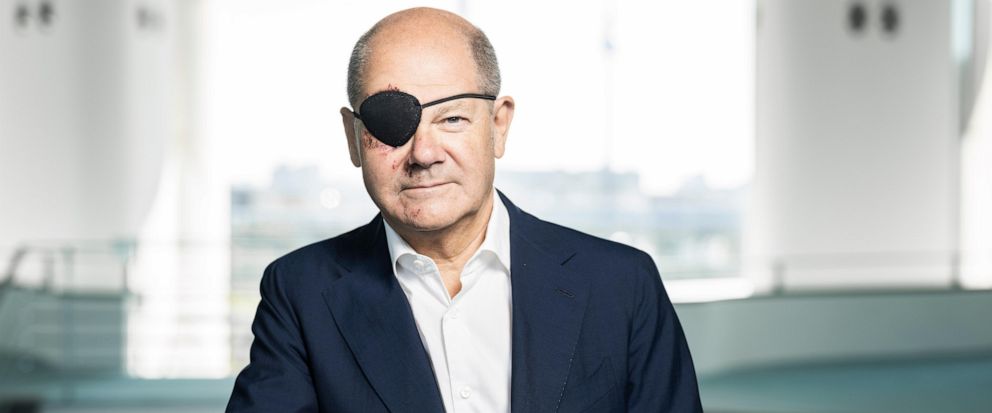 German chancellor Scholz tweets picture with eye patch after 'jogging accident' - Disclose.tv