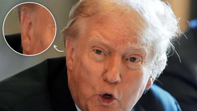 Donald Trump visto in pubblico senza benda all'orecchio: nessun segno evidente di croste o cicatrici - Grandeinganno